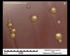 staphylococci on chocolate agar